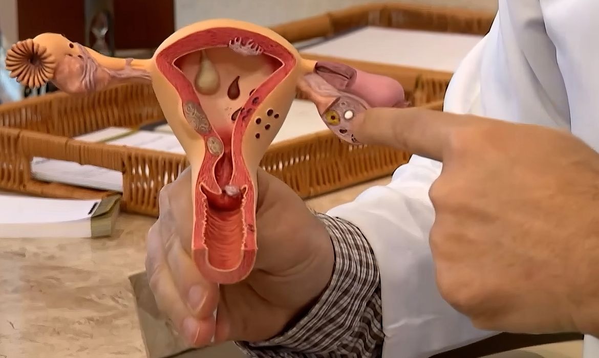 CNPq recebe projetos sobre endometriose até 12 de agosto