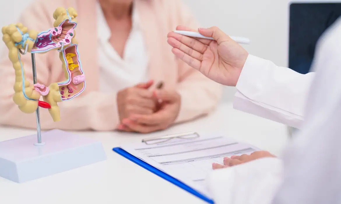 Câncer colorretal: novo teste passa a ser oferecido pelo SUS