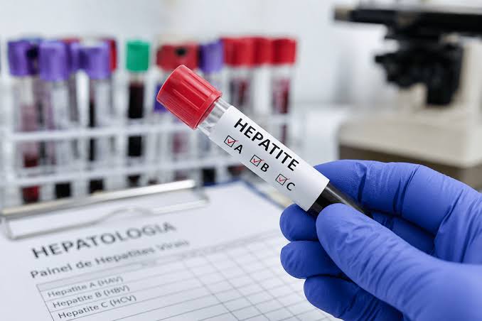 Pesquisa revela cenário das hepatites virais no Brasil